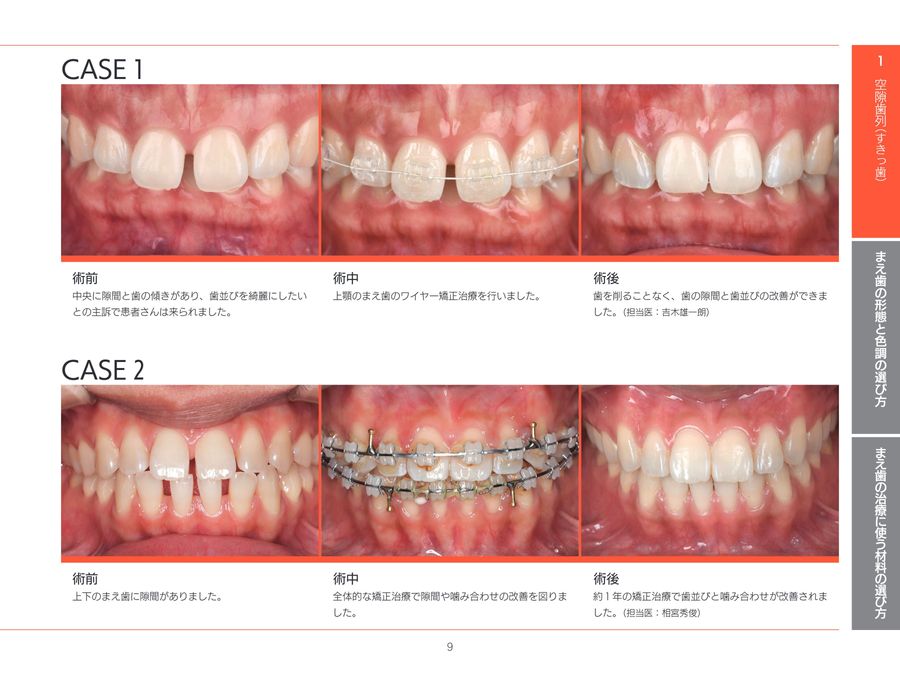 審美歯科治療ガイド