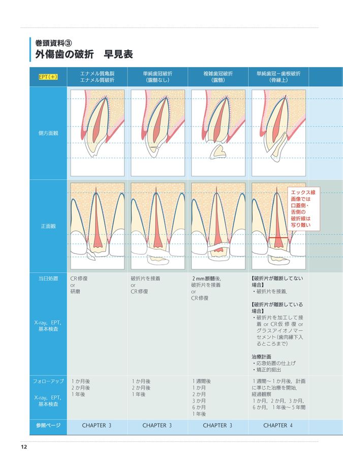 超速でわかる_外傷歯にやっていい治療_だめな治療