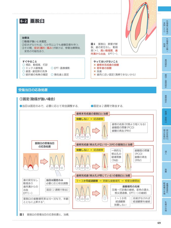 超速でわかる_外傷歯にやっていい治療_だめな治療