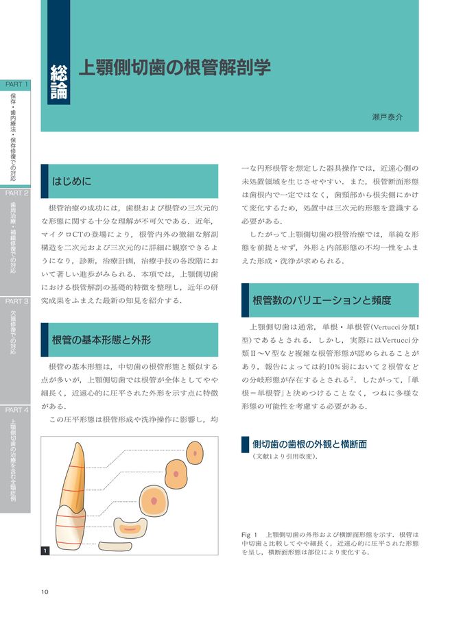 上顎側切歯の治療戦略
