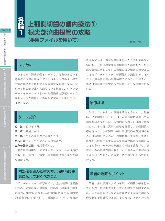 長期経過症例から紐解く根尖病変と骨縁下欠損 下川 倉富 上顎側切歯の