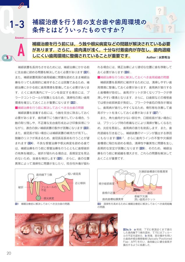 驚くほど臨床に深みが増す！_こだわり補綴サブノート
