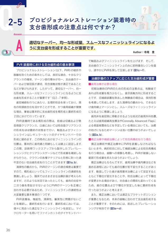 驚くほど臨床に深みが増す！_こだわり補綴サブノート