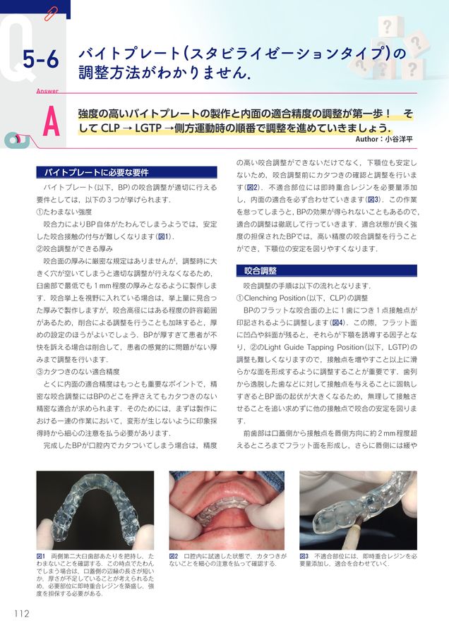 驚くほど臨床に深みが増す！_こだわり補綴サブノート