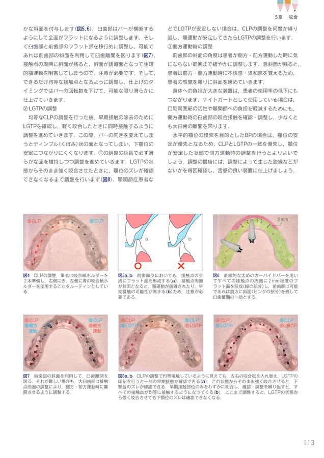 驚くほど臨床に深みが増す！_こだわり補綴サブノート