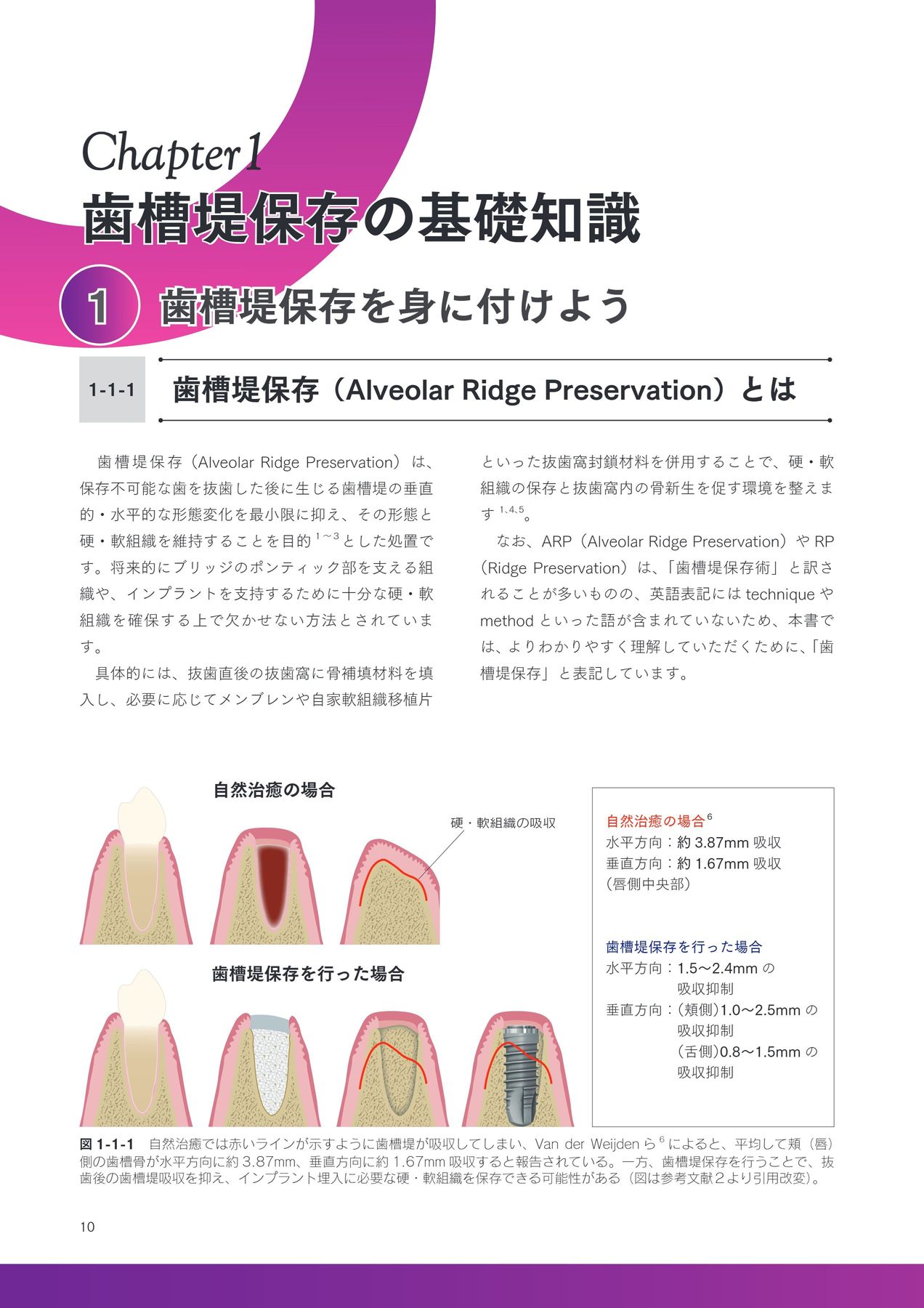 【裁断済み】ベーシック 歯槽堤保存 ベーシック歯槽堤保存 岡田素平太(著) - クインテッセンス出版 | 版元
