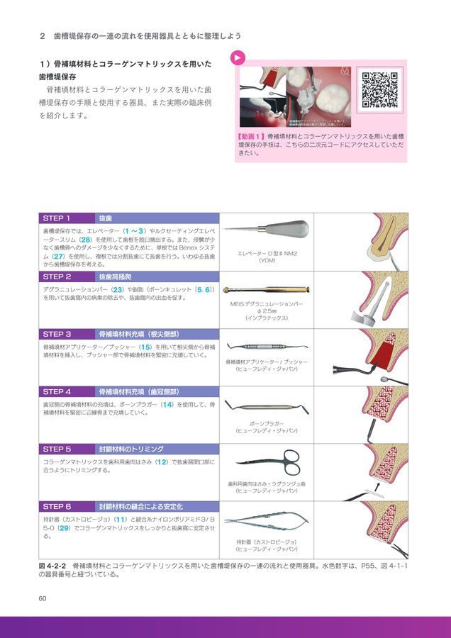 ベーシック歯槽堤保存