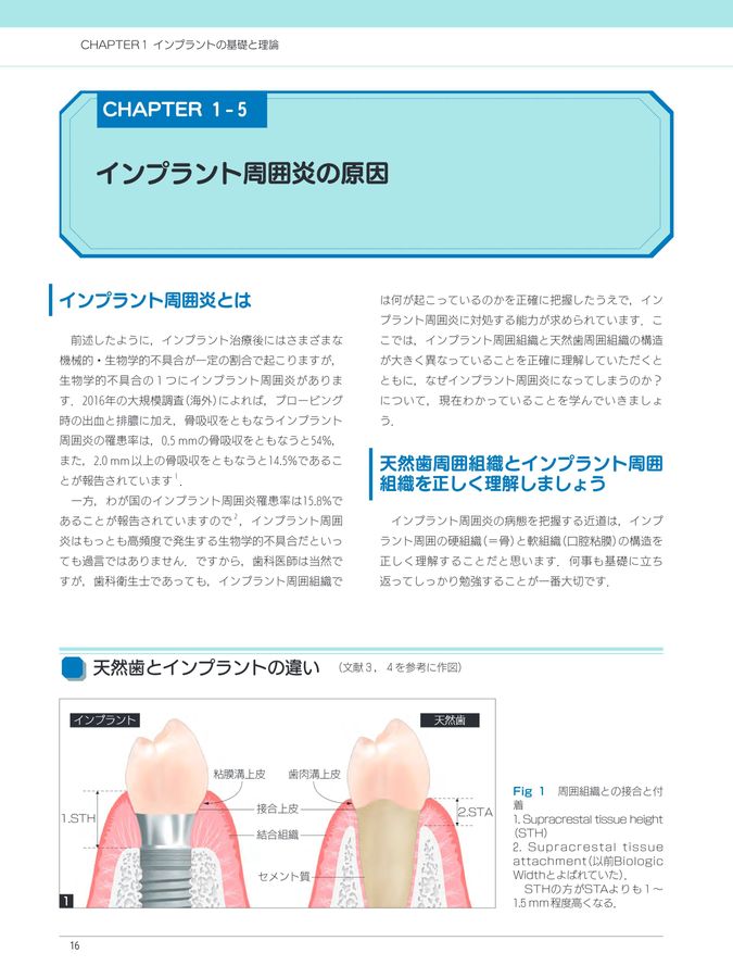 そこが知りたい！ Dr.とDHのためのインプラントのメインテナンス