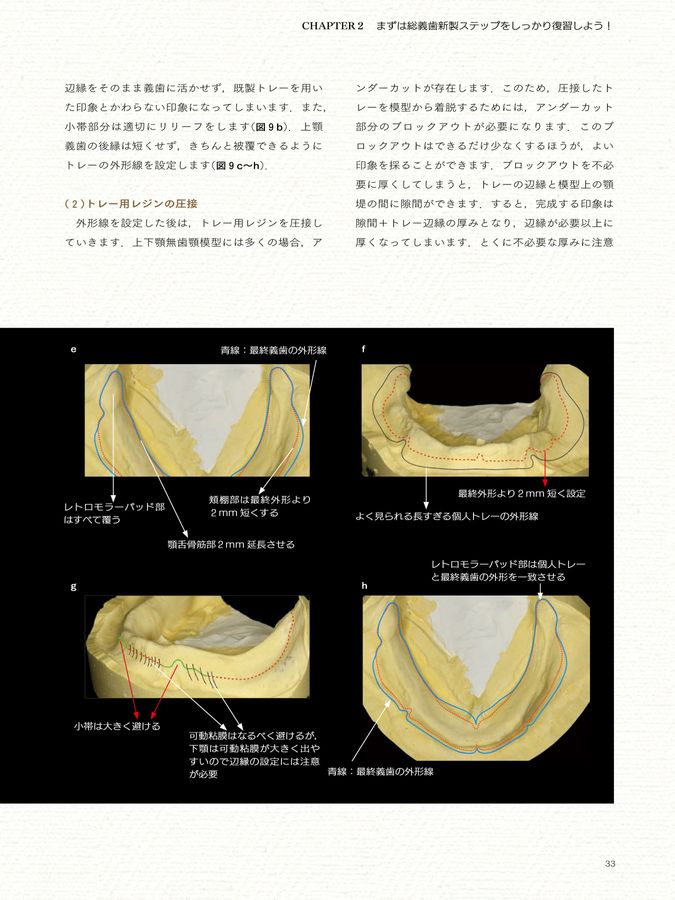 しっかり説明できる本6総義歯治療読本