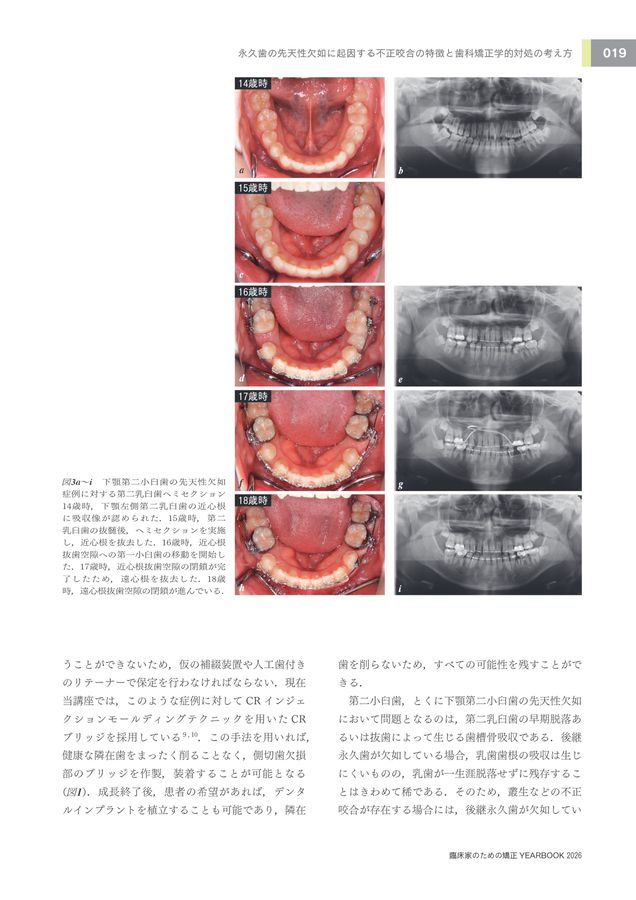 臨床家のための矯正YEARBOOK2026