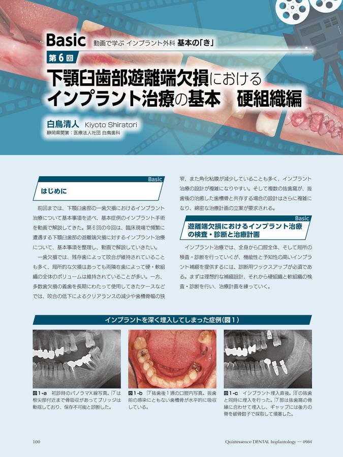 Quintessence DENTAL Implantology 2024年No.6