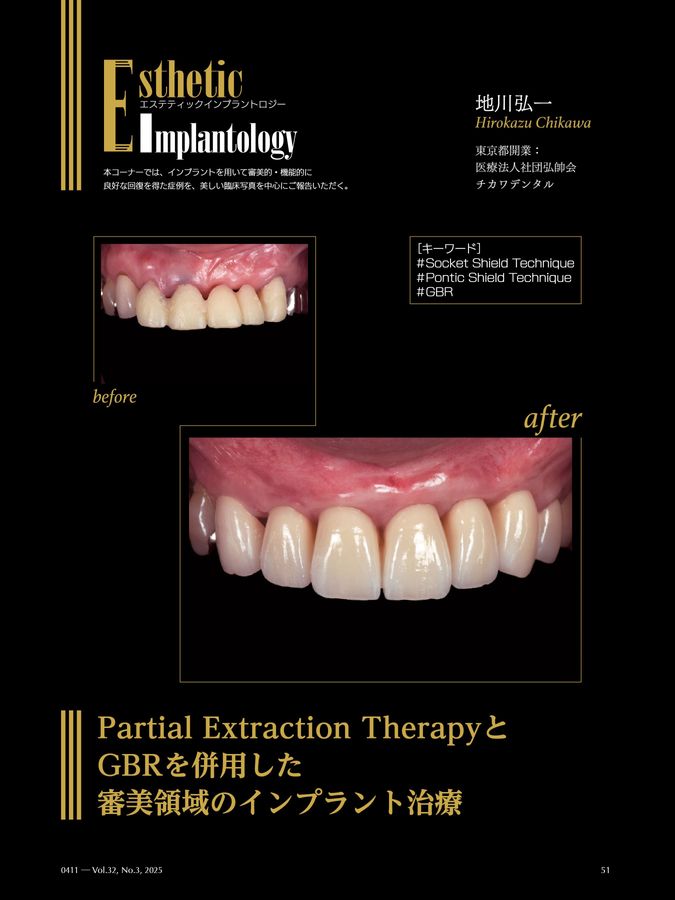 Quintessence DENTAL Implantology 2025年No.3