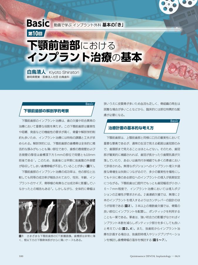 Quintessence DENTAL Implantology 2025年No.4