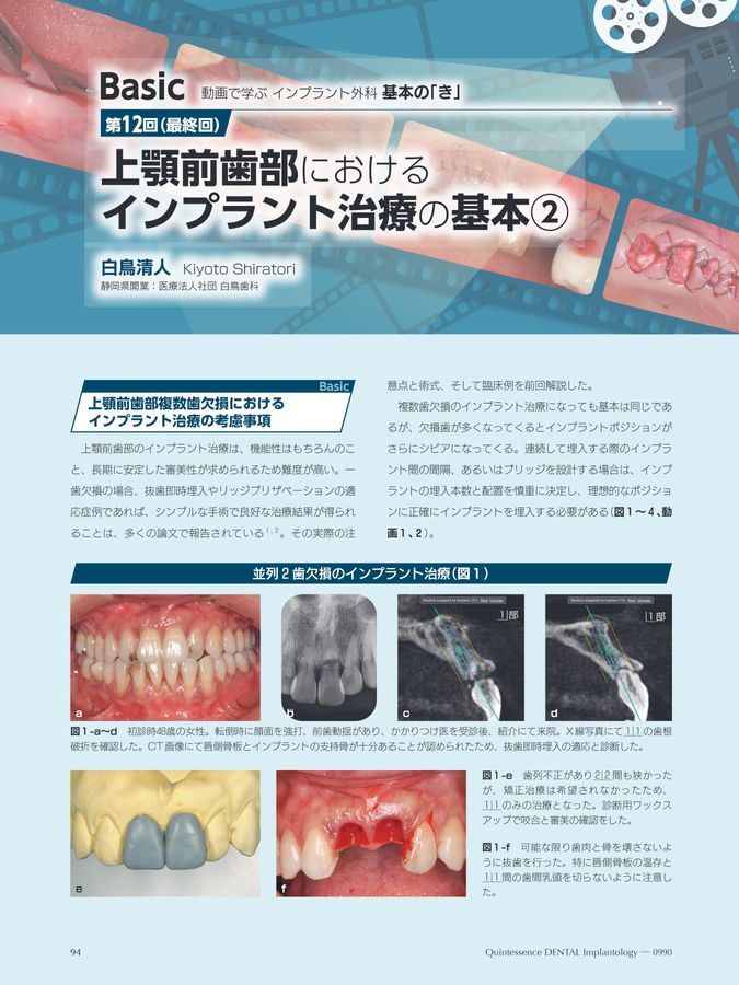 Quintessence DENTAL Implantology 2025年No.6