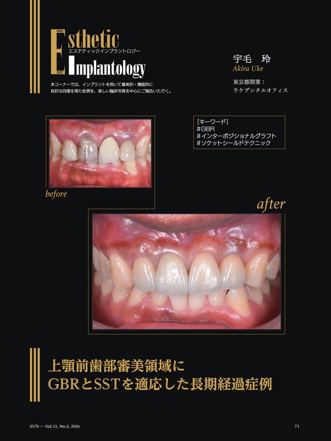 まとめ売り【裁断済み】DENTAL Implantology 2020〜2023 Quintessence DENTAL Implantology 2026年No.4