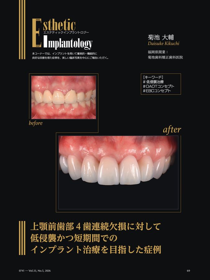 Quintessence DENTAL Implantology 2026年No.5
