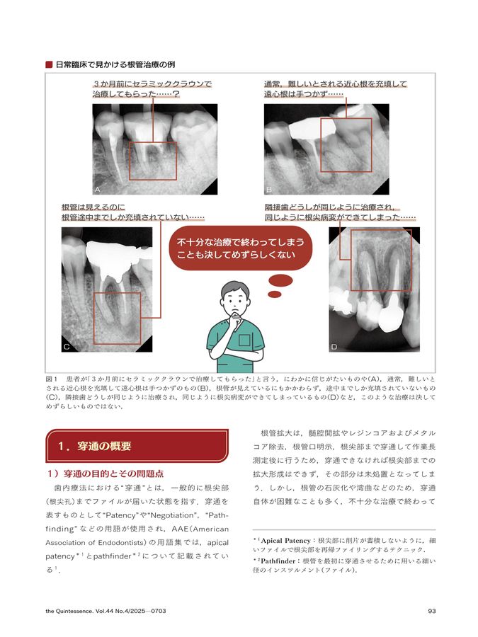 【裁断済】歯周炎ステージ1・2・3診療ガイドライン : Q&Aで紐解く! 歯周炎ステージ1・2・3診療ガイドライン Q＆Aで紐解く
