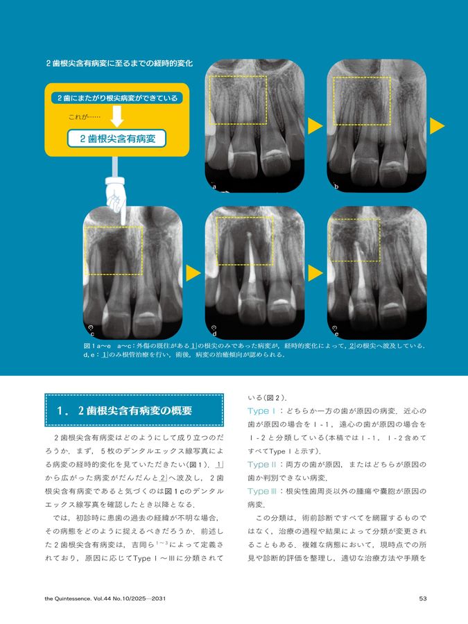 ザ・クインテッセンス 2025年10月号