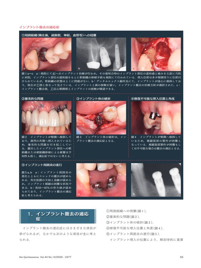 ザ・クインテッセンス 2025年12月号