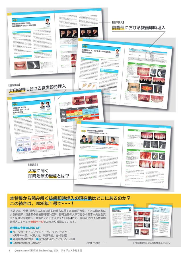 Quintessence DENTAL Implantologyダイジェスト 見本誌2026